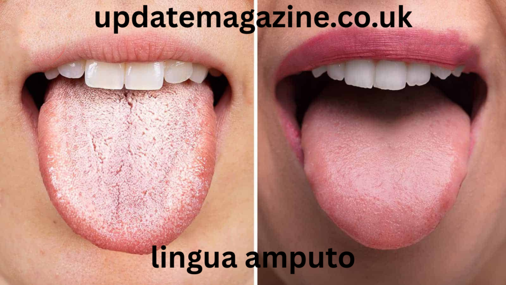 lingua amputo
