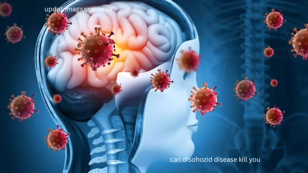 can disohozid disease kill you